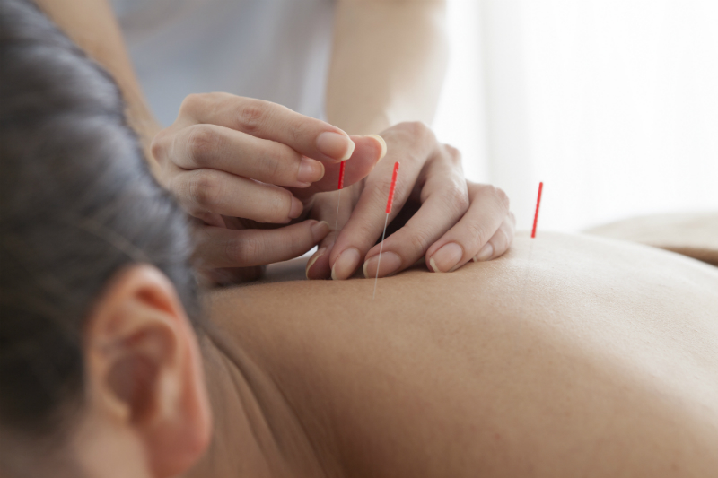 Three Tips for Deciding Which Seattle Acupuncturist to Choose