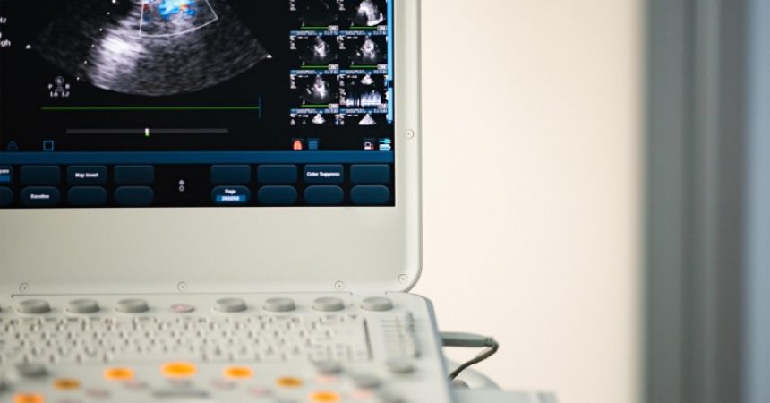 How to Choose a Veterinary Ultrasound Machine in North Charleston, SC