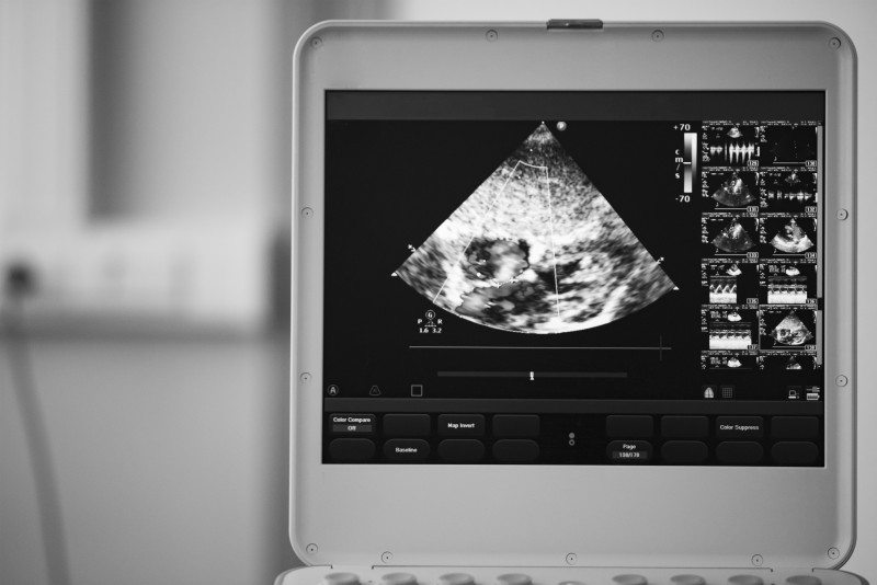 Reasons to Choose a Used Ultrasound Machine for Sale in Charleston, SC