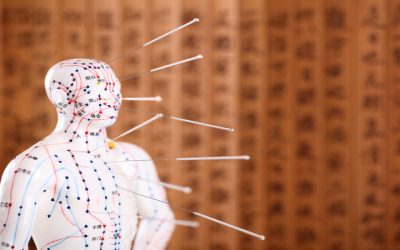 Improve Daily Comfort Through Acupuncture For Pain Bellingham WA Proven Techniques