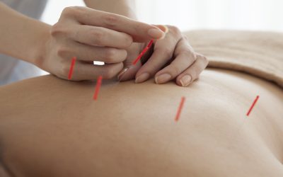 Reduce Anxiety and Boost Wellbeing Through Acupuncture For Stress In Berkeley, CA