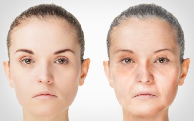 Reduce Wrinkles and Fine Lines by Choosing Botox Venice FL for LongLasting Results